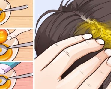 7+ home remedies to aid with hair growth